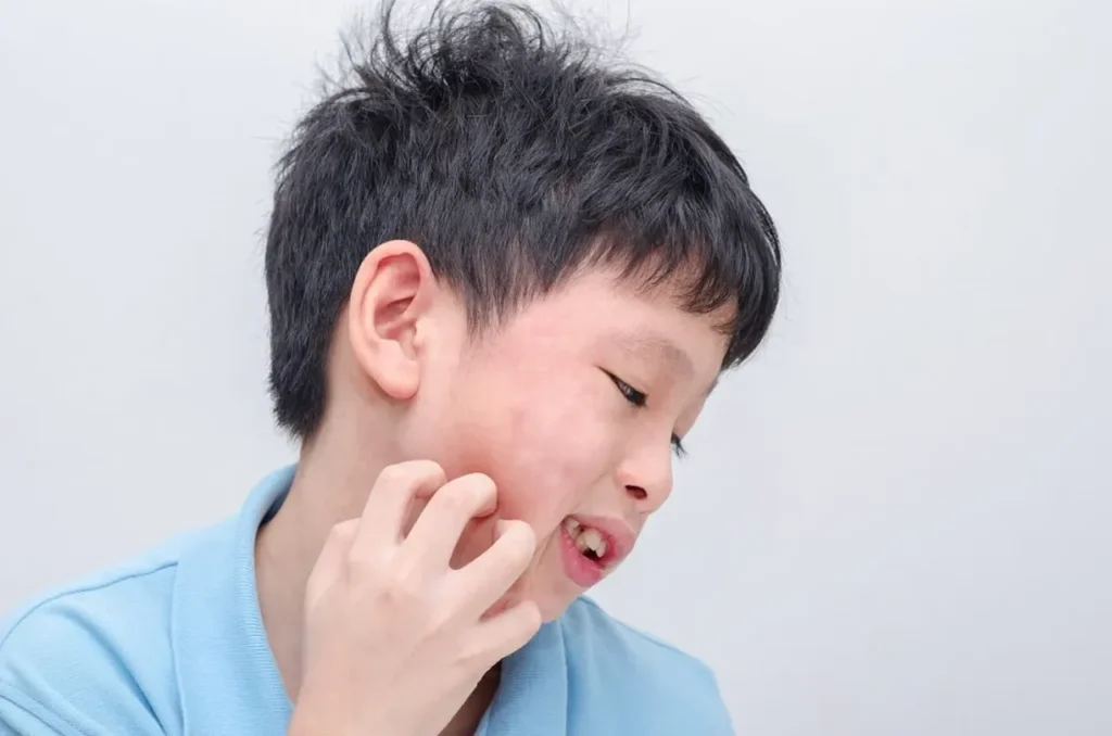 How Do Genetics Increase Your Risk of Allergies